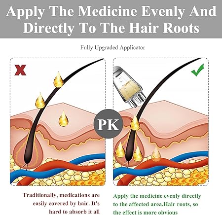 Mini Hair Oil Applicator Comb – Easy Scalp Massage (6ml)